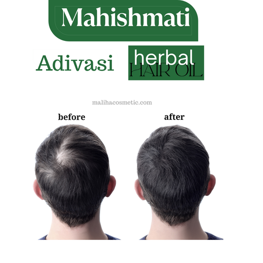Kisra Adivasi Hair Oil – 100% Natural for Hair Growth & Strength